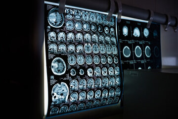 Bild der Petition Solidarität und Erhalt der Kliniken für Neurologie und Psychosomatik (Vitos Klinikum Weilmünster)