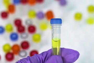 Bild der Petition Wiederaufnahme der PCR-Pooltestungen in allen Krefelder Kitas